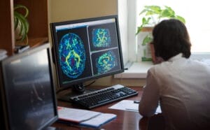 A Dr. is working on a scan of a brain