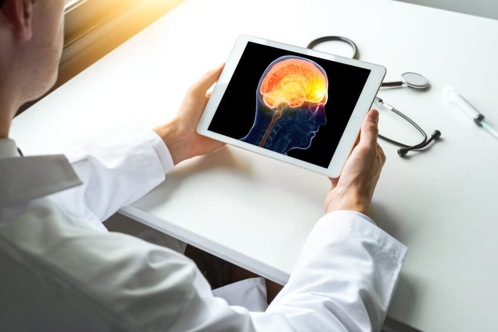 Doctor watching x-ray of brain disease on a digital tablet. Migraine or headache concept